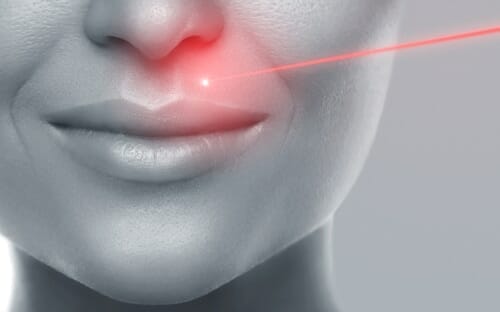 laser-photorajeunissement.jpg