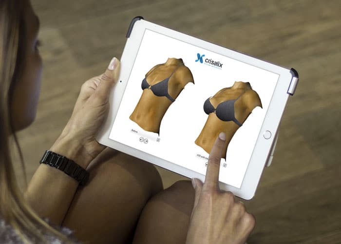 Votre consultation 3D