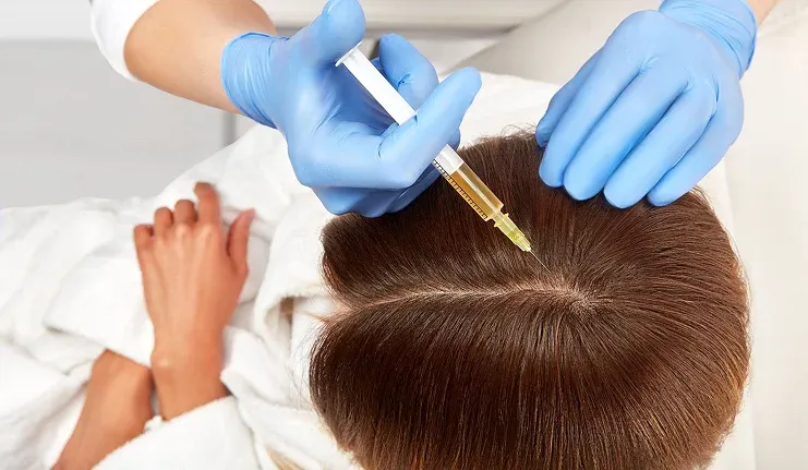 injection-prp capillaire.webp