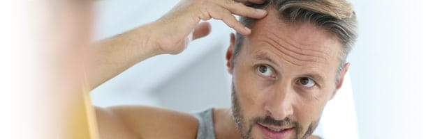 Greffe de cheveux