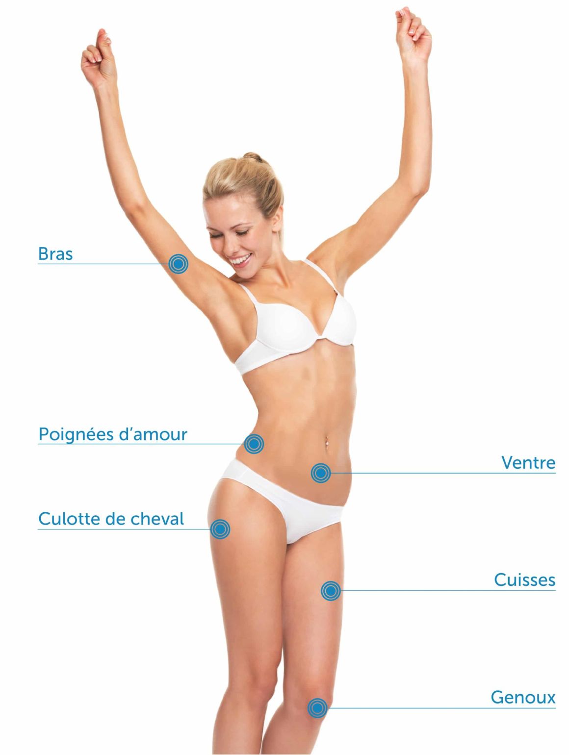 Cryolipolyse