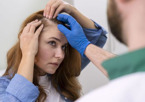 Greffe-de-cheveux-FUE-pour-femmes-scaled.jpg