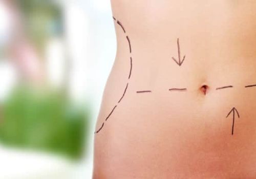 chirurgie-de-la-silhouette.jpg