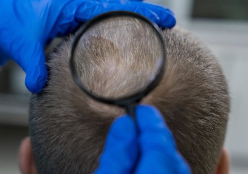 Diagnostic-capillaire-clinique-du-lac-scaled.jpg
